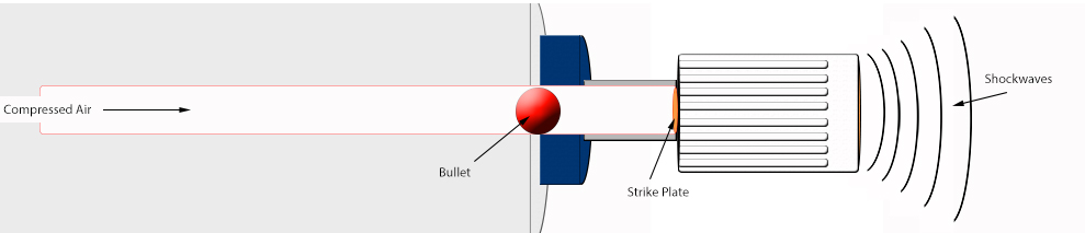 Shockwave Therapy